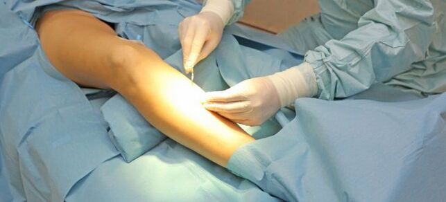 Surgical methods